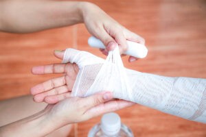 Floral Park Burn Injury Lawyer